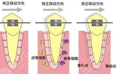 閔行中心醫(yī)院矯正牙齒怎么樣