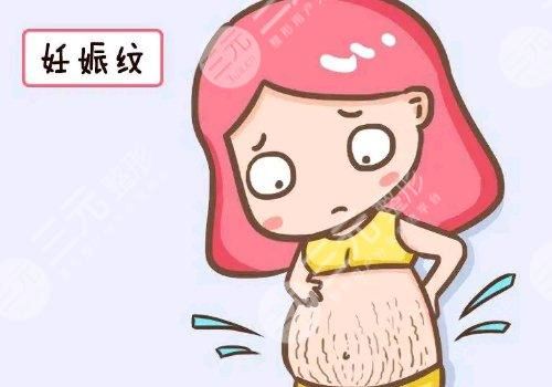 妊娠紋怎么可以徹底消除