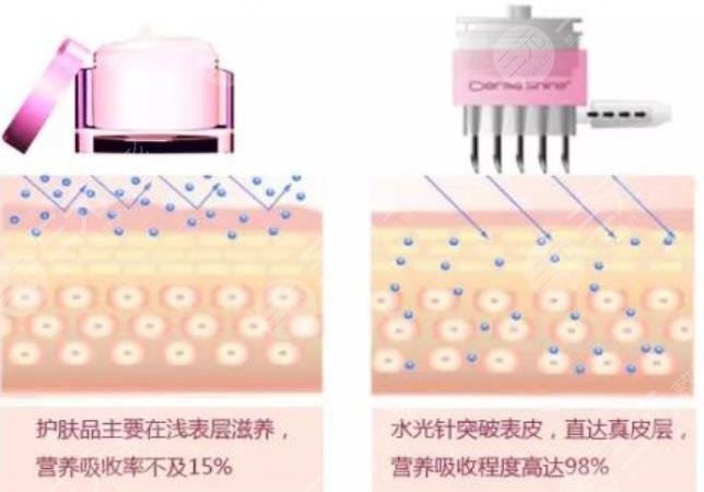 水光補(bǔ)水的主要功和副作用是什么