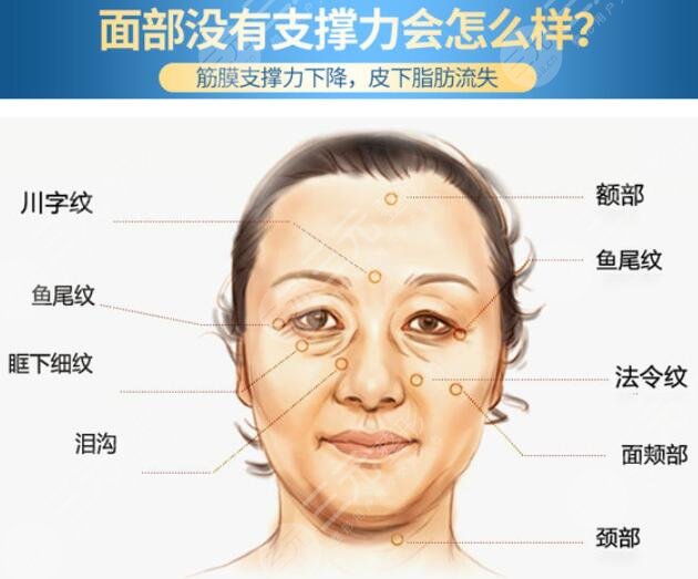 2022上海拉皮手术专家排名榜
