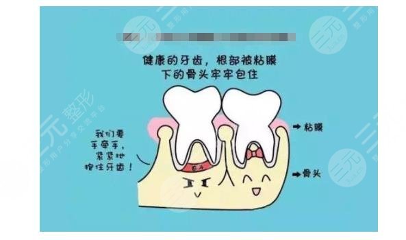 牙齒松動(dòng)有什么辦法恢復(fù)