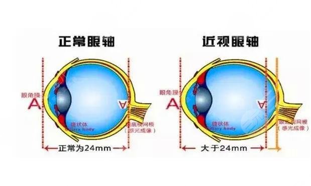 人凸眼與正常眼睛圖片有哪些區(qū)別