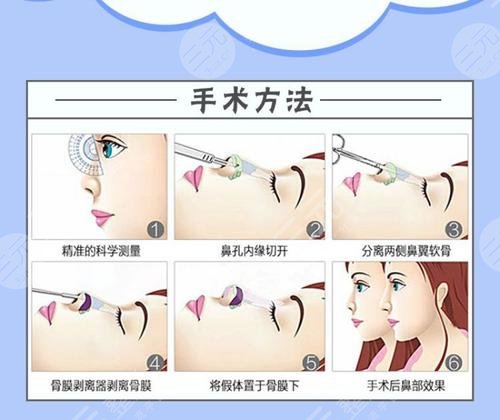 上海鼻整形专家医生排名新发布