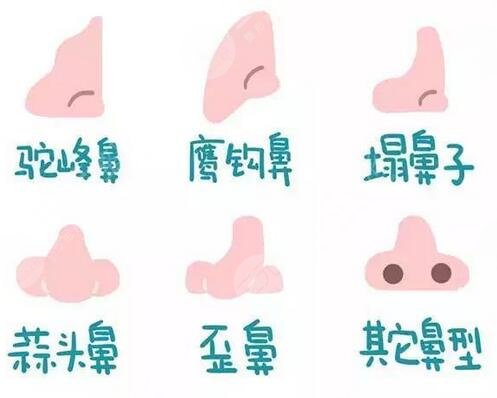 深圳隆鼻专家前十名名单