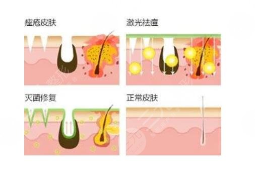 北京艺星和伊美尔哪个好