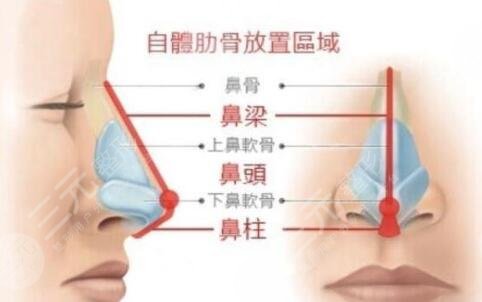 2022北京鼻部手术十大专家排名大全