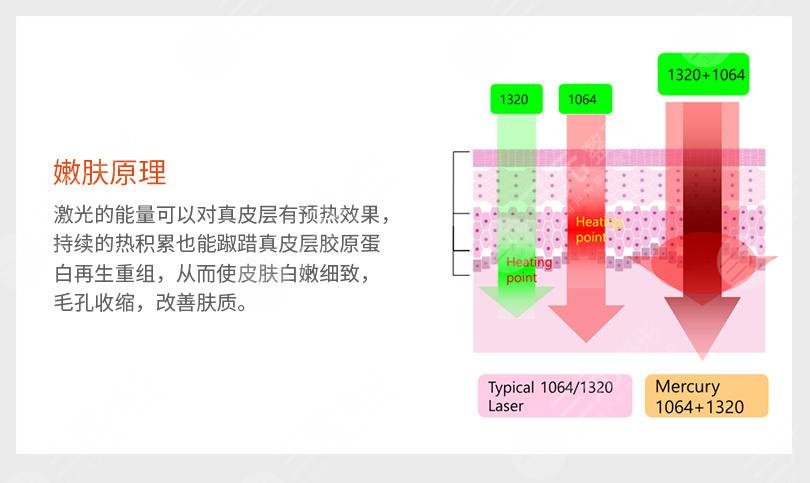 激光嫩膚有后遺癥嗎