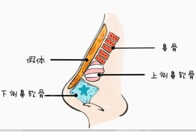 別箏醫(yī)生做鼻子好嗎