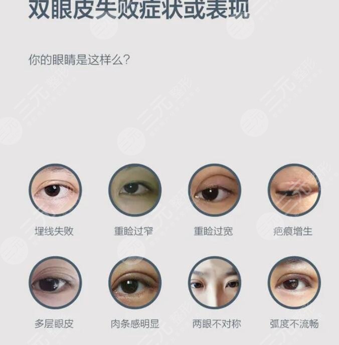 北京八大处双眼皮修复专家名单