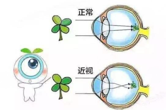 上海九院眼科专家排名来袭