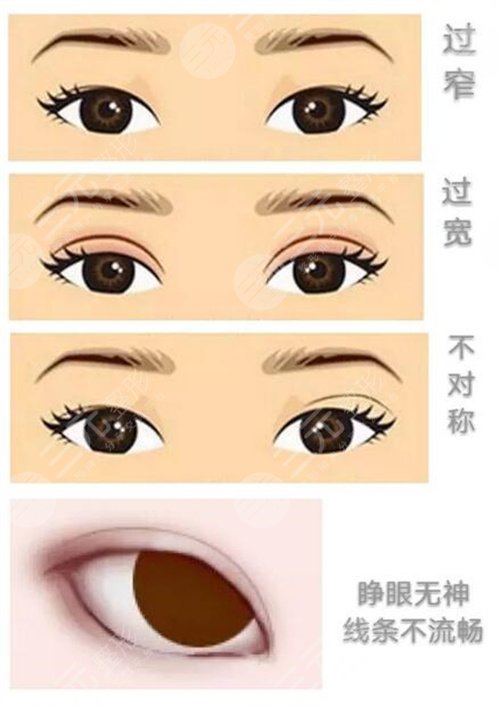 上海双眼皮医生排名「榜单」专家排行榜