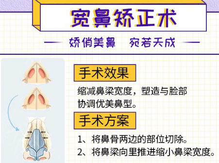 薛提朋做鼻子怎么樣