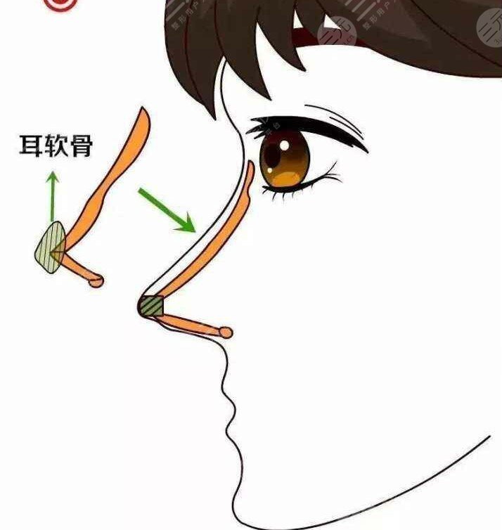 北京李医生医疗整形外科做鼻整形怎么样、多少钱