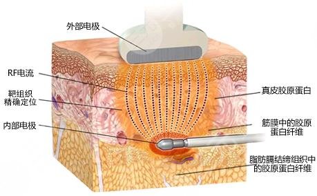 八大處何樂人耳部修復(fù)技術(shù)怎么樣