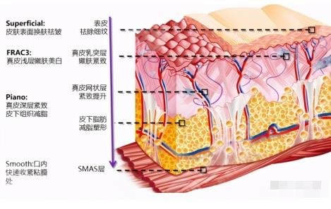 歐洲之星VS熱瑪吉