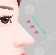 長沙星雅整形醫(yī)院怎么樣