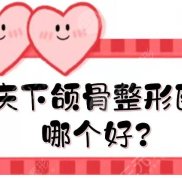 重慶下頜骨整形醫(yī)生