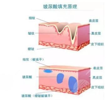 施爾美和美貝爾哪家技術(shù)好