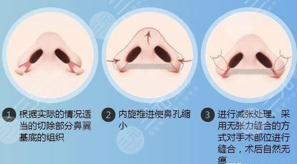 上海鼻整形专家排名榜