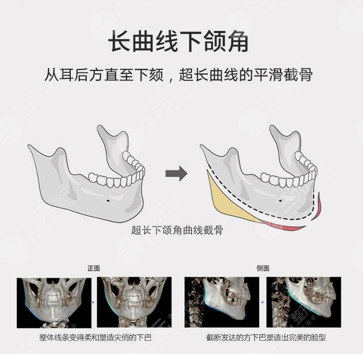 上海下頜角磨骨人氣醫(yī)生名單