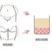 沈陽元辰醫(yī)美口碑咋樣