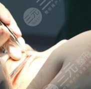 武漢做雙眼皮修復(fù)厲害的醫(yī)生是誰