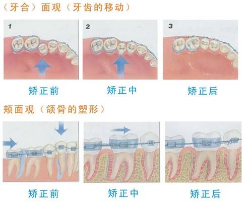 蔣自強醫(yī)生怎么樣