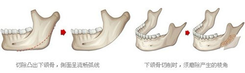 十大改臉型整形醫(yī)院盤點(diǎn) 改臉型哪家醫(yī)院好