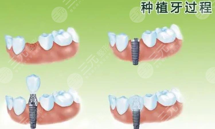 2022杭州矫正牙齿好的口腔医院有哪些