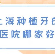 上海種植牙的醫(yī)院哪家技術(shù)好