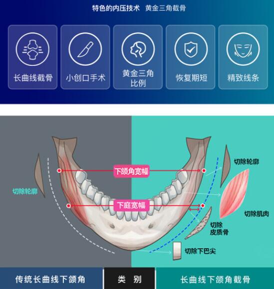 武漢大學口腔醫(yī)院吳中興教授簡介