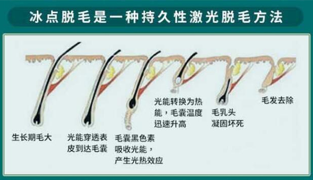 胡子長得快怎么辦