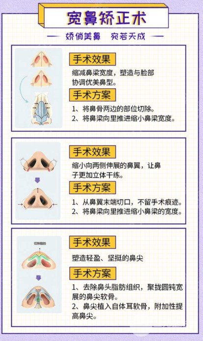 鼻子歪了有必要矯正嗎