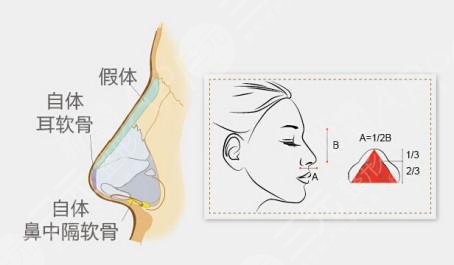 貴陽華美和美萊誰好點(diǎn)