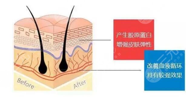 深藍射頻好還是熱瑪吉果好