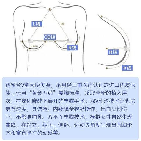 成都做隆胸的医生比较好的专家排行榜2022心选红榜出炉