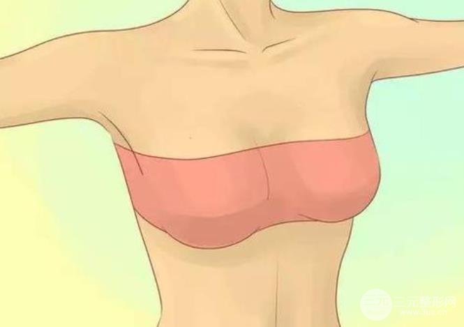 女人胸部下垂怎么恢复
