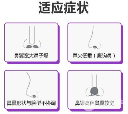 縮小鼻頭手術(shù)失敗會(huì)發(fā)生什么