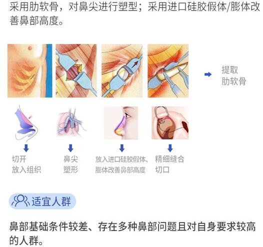 深圳十大鼻子整形医生排名榜