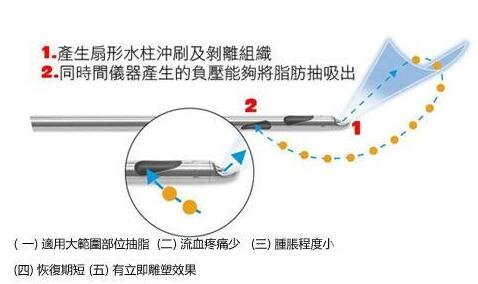 360水動力吸脂減肥價格和對比圖