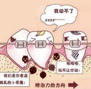 成都出名的牙齒矯正醫(yī)院有哪一些
