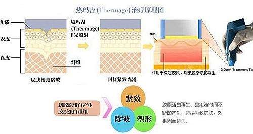 做完熱瑪吉后臉垮了