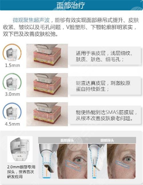 熱瑪吉四代一次多少錢