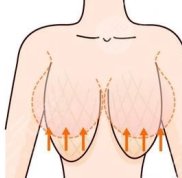 無錫巨乳縮小哪家醫(yī)院好