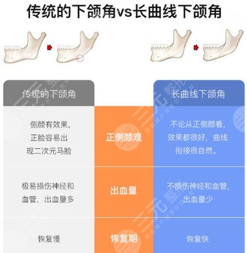北京做下颌骨手术好的医院排行榜
