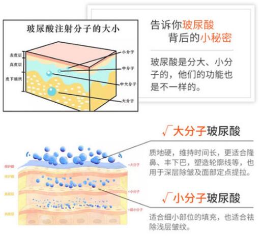 15條醫(yī)美科普干貨滿滿