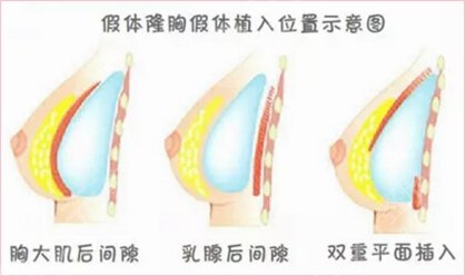 2022成都醫(yī)美醫(yī)院排名更新啦