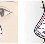 上海隆鼻好的醫(yī)院有哪些