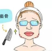 成都下頜骨整形醫(yī)院前5榜單排名公布