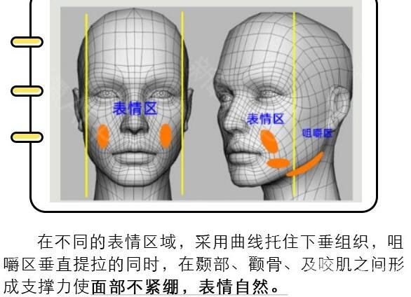 熱瑪吉好還是埋線除皺好